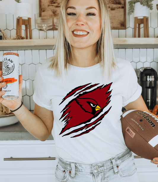 Chest tear - Arizona Cardinals