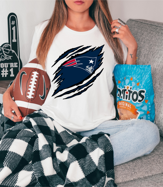 Chest tear - New England Patriots